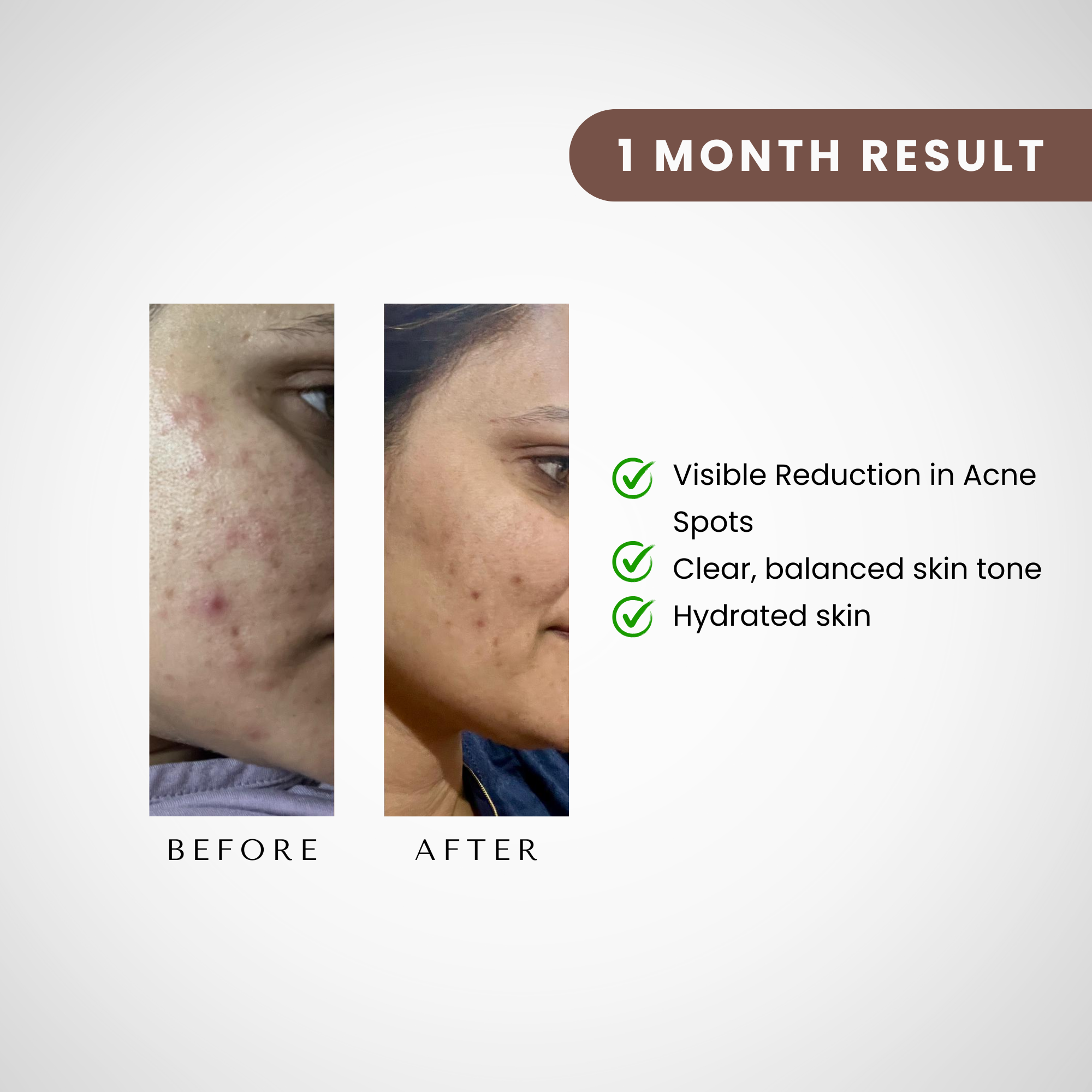 Jeevastha Alovera Gel